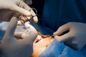 Preparing for dental surgery a step by step checklist