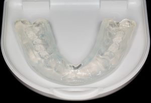 using the right mouthguard for contact sports